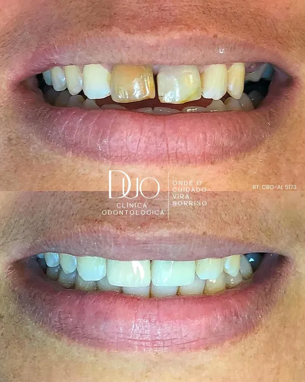 Procedimento de Harmonização do Sorriso e Estética Facial Odontológica